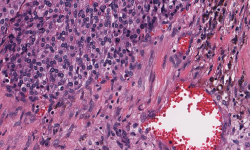 Featured image of post How Can We Analyze Large Medical Images to Detect Brain Tumors? A Practical Guide