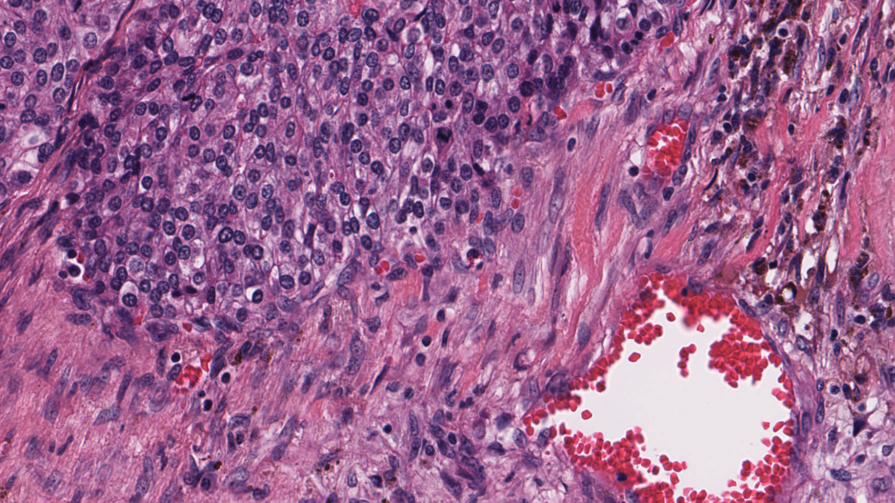 Featured image of post How Can We Analyze Large Medical Images to Detect Brain Tumors? A Practical Guide