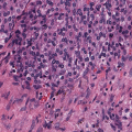 How Can We Analyze Large Medical Images to Detect Brain Tumors? A Practical Guide