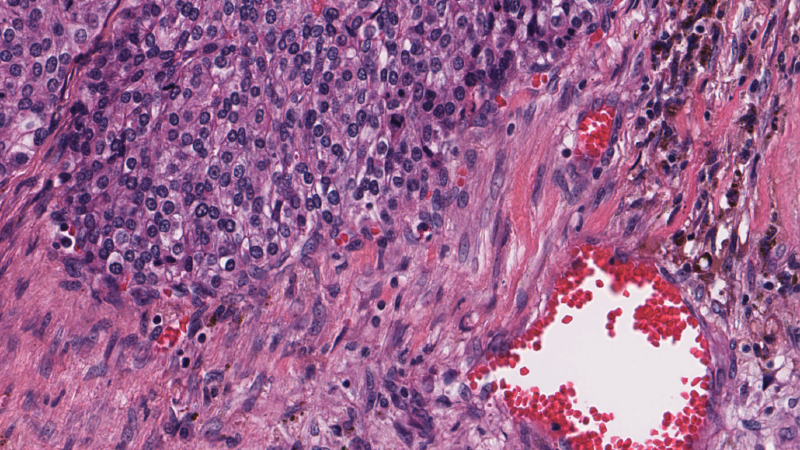 Featured image of post How Can We Analyze Large Medical Images to Detect Brain Tumors? A Practical Guide